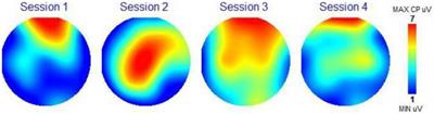Case report: binaural beats music assessment experiment